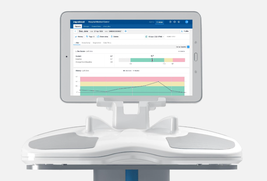 SOZO FDA-cleared bioimpedance spectroscopy device showing L-Dex measurement data on a tablet screen